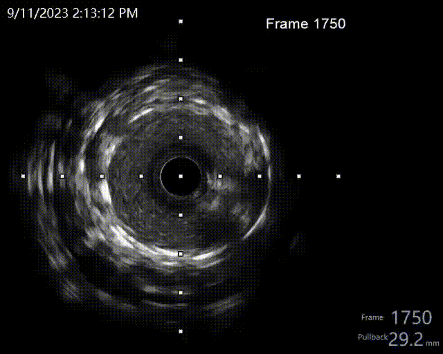 1770ececb093f4413647442a4333f3ec 00_00_00-00_00_30.gif